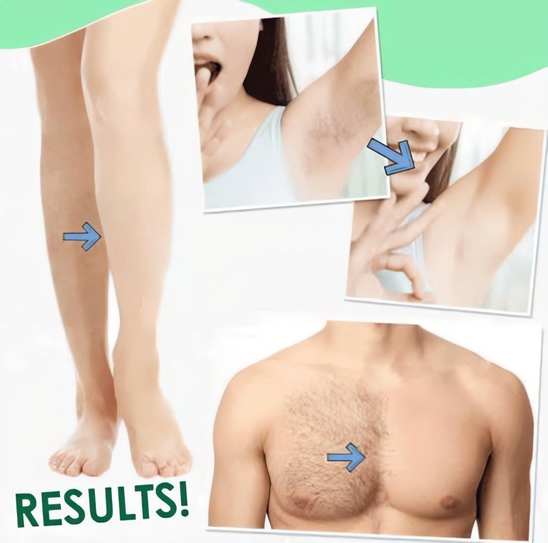 Sydonic Permanent Hair Removal Treatment