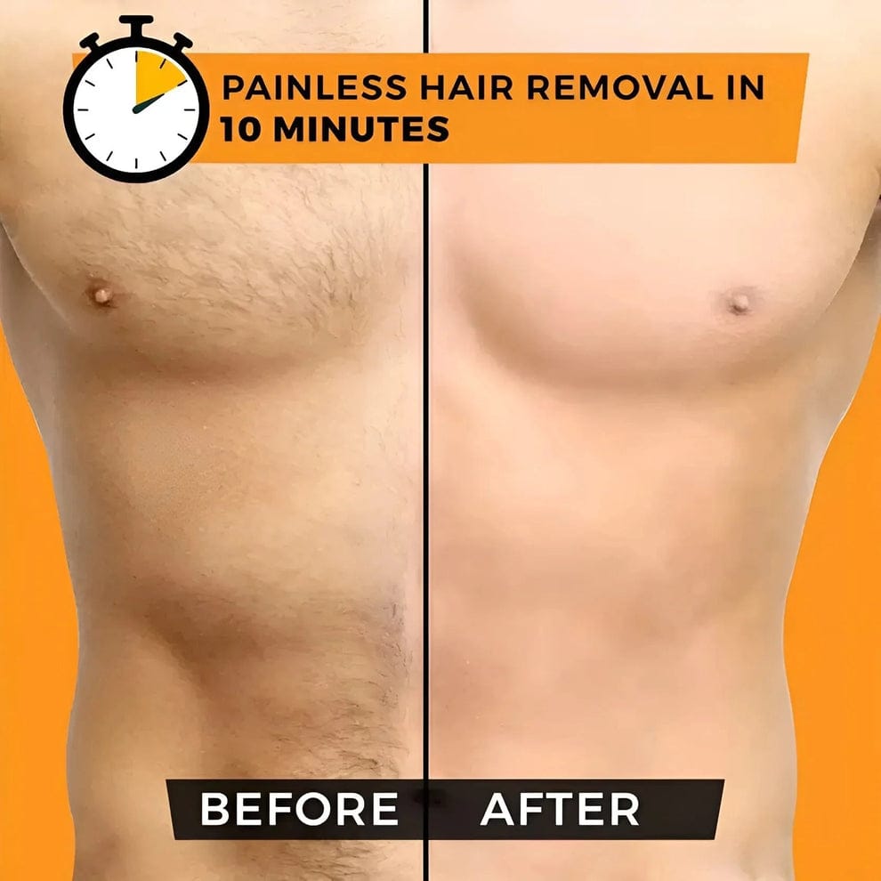 Sydonic Permanent Hair Removal Treatment