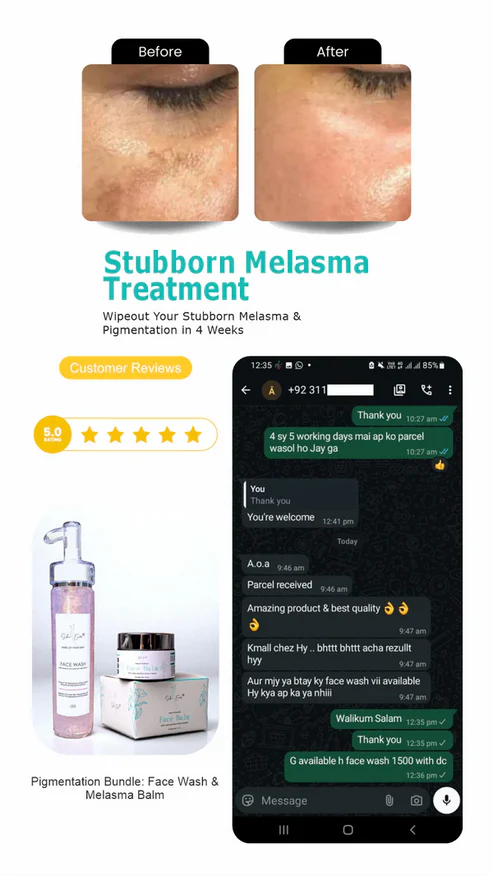 Face Balm For Melasma 50% off & free delivery